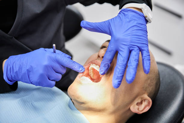 Best Emergency Root Canal Therapy in Butler, IN