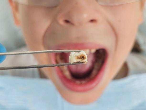 Best Walk-In Emergency Dental Services in Butler, IN